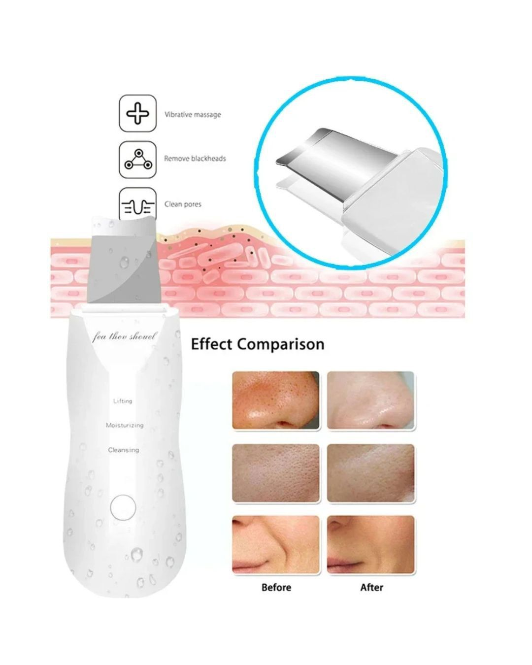 Limpiador Facial Ultrasonico